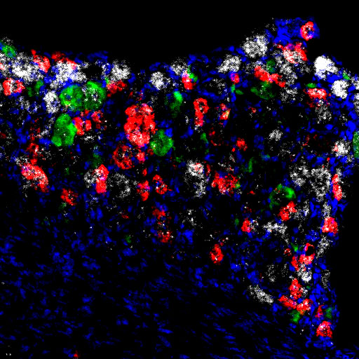 TheMedicaltech's tweet photo. Researchers Discover Intracellular Circuit Responsible for Chronic Pain
https://t.co/yCNSqfTEvc https://t.co/2zhpFtdec5