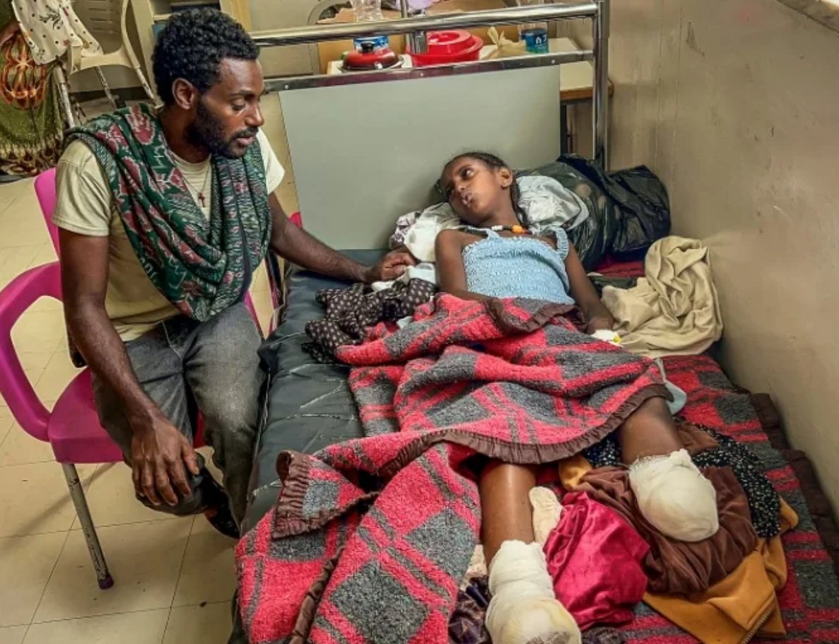 addisstandard's tweet photo. 'The sound keeps coming back': children maimed in #Ethiopia's #Tigray clashes

Lying on a hospital bed, rolled-up blankets propping up the remains of her legs, 10-year-old double-amputee Iyerusalem is among scores of civilians wounded in northern Ethiopia after fighting erupted last month.

*** 
"I was in our compound with my older brother and our horse when we were hit. My brother and the horse died," she told AFP from Ayder Comprehensive Specialized Hospital in #Mekelle, capital of the northern Tigray state.

Many of the wounded live in remote villages hours from the hospital along difficult roads where there has been fighting and shelling.

"Right now, my amputated legs hurt badly," said Iyerusalem, who comes from Qarsole village in Alamata district, south of Mekelle.

"If I get medical treatment and can walk again, I want to go back to school," she said, as her father Hiluf watched anxiously.
https://t.co/7FT93OYs3O