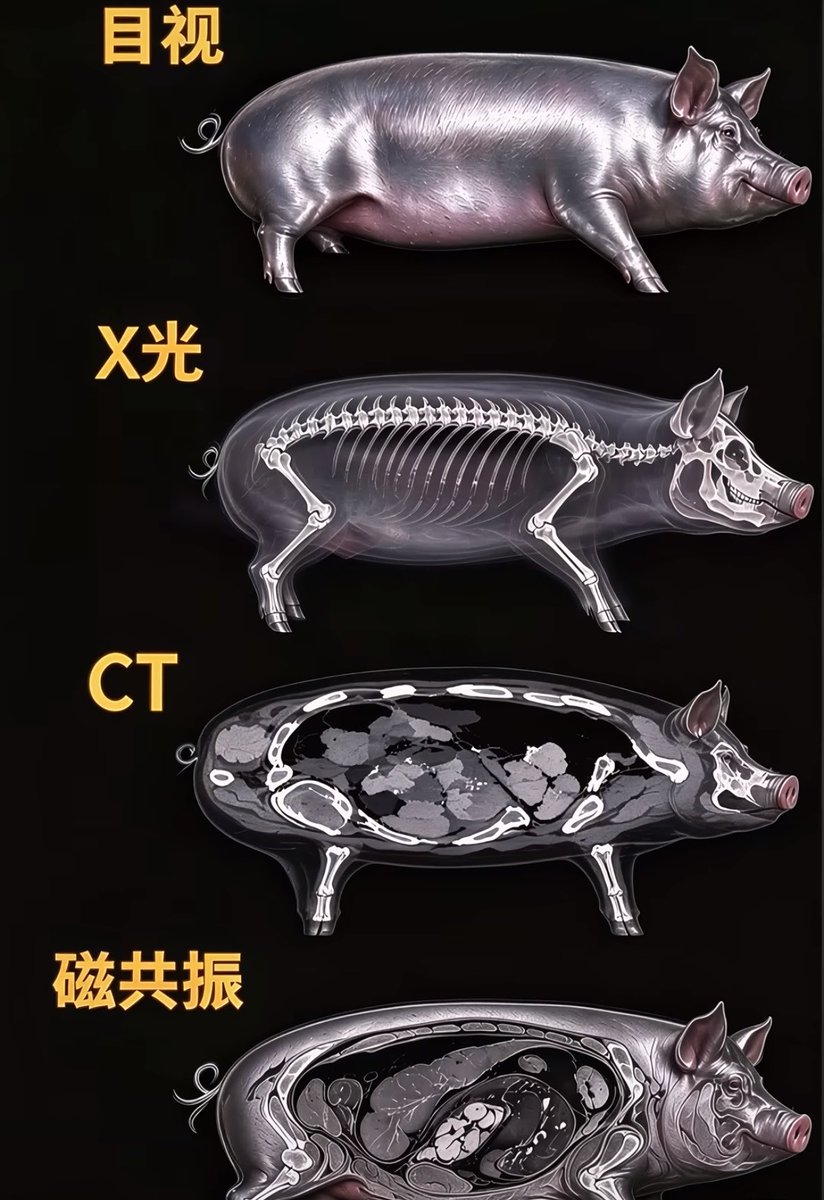 longyushuang's tweet photo. 一张图看懂影像的区别 https://t.co/K6eVTS8m04