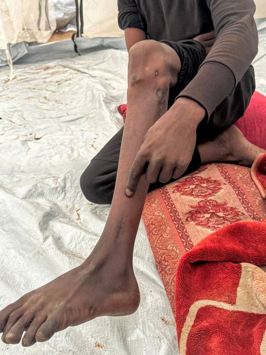 RamiUbaid97990's tweet photo. I BEG YOU DONT SKIP!!
I ask everyone to share this post, so we reach a large number of people who can help! 
Share, donate and Reply with 🇵🇸🍉
https://t.co/E7TbF8Pshx https://t.co/7nZBeo8SER