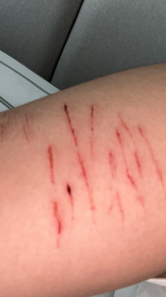 nashash066's tweet photo. FAKE GENERATED WITH AI!!!
block dont report

anyways these are some better pics of last night
styros and bby beans (??) https://t.co/MW8a8Vcm42