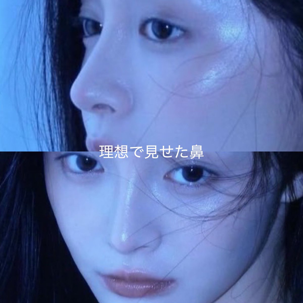 拡散希望

鼻整形失敗かも。執刀医「これ以上ご希望に沿った結果を責任持ってお約束することが難しい」「理想のデザインに近づけるなら軟骨取って建て直ししかない（自費）」←それなら初めからそう言って欲しい。
大金払ってこの仕上がりといわれたらこの執刀医に任せたいと思いますか？

#鼻整形 https://t.co/NCzq1Lx5pA