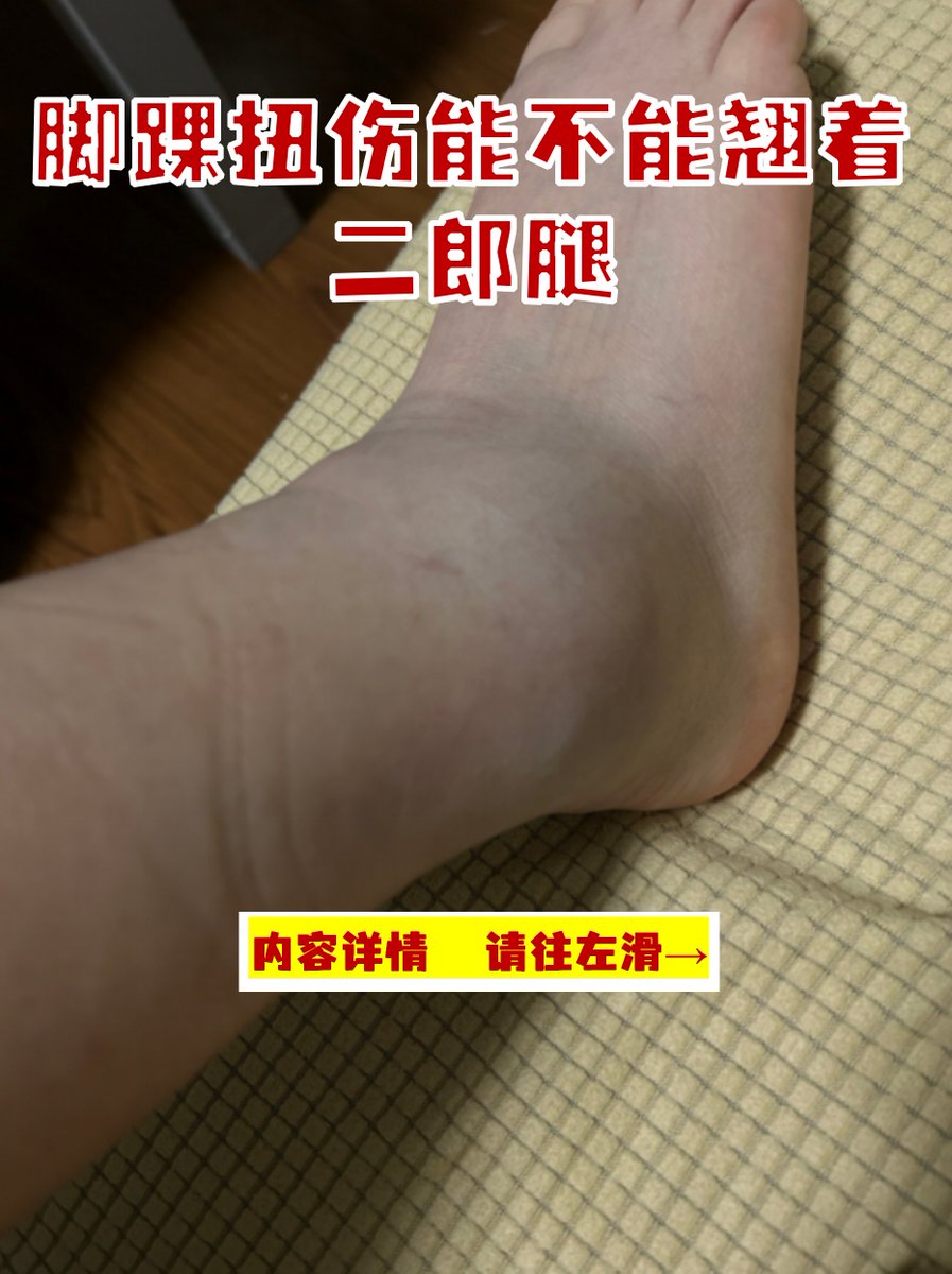 Pach49601440's tweet photo. My leg almost got injured when I tried a silly stunt, don’t mess around with risky moves! https://t.co/oYusFkf7Ly