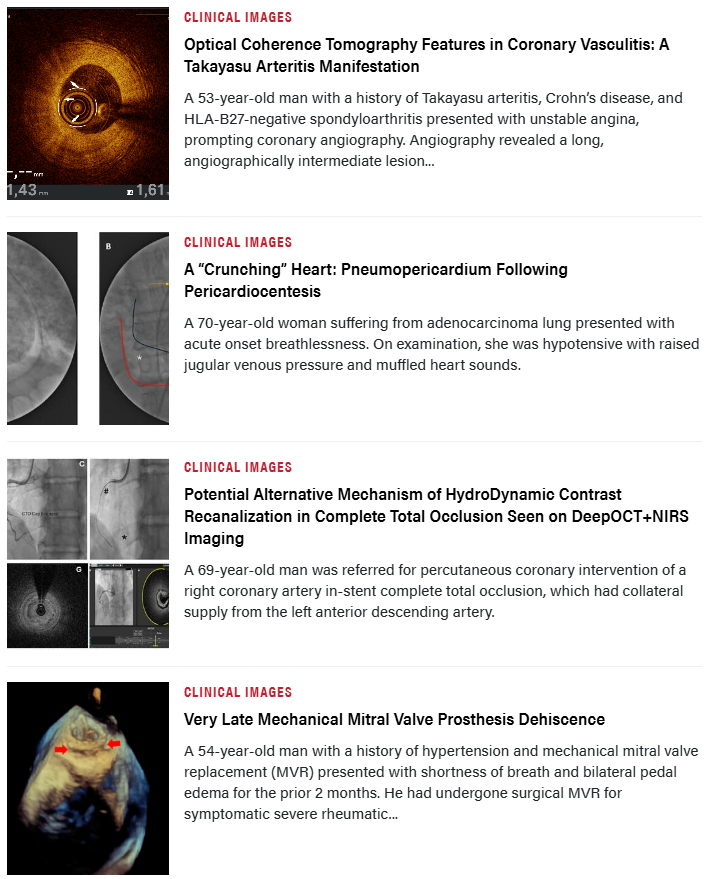 InvasiveCardiol's tweet photo. 📚 The October issue is out now! Read here: https://t.co/OmFZRdFZlI

@yadersandoval @Montyks3 @CamachoFreire @mohanedegred @nicodcs28 @AgstamSourabh @ktheod2005 

@DLBHATTMD #cardioTwitter #cardioX #cardiology #interventionalcardiology https://t.co/Adtp0Selag