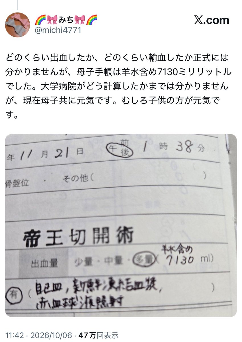 yominokuni140's tweet photo. 【悲報】

「出産は命懸け」という話題に対して、出産時に7リットル出血して死にかけた女性の体験談が話題に
↓
X民
・嘘松
・7L出血は笑うしかない
・嘘ばっかり
・オオカミ少年の話知らないの？
↓
母子手帳により事実であることが確定。X上の産科医達からも事実であるとの認識で一致
↓
X民「でもその7Lで亡くなってないよね？どこが命懸け？」
↓
「出産は命懸けじゃない」派の頭が悪すぎると話題に←今ここ