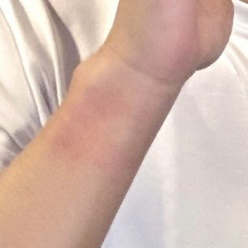 m4tz_ricecooker's tweet photo. poor kitty was tied up for so long his wrists have these pretty pretty red marks(╥﹏╥) https://t.co/FnYIfABDmf