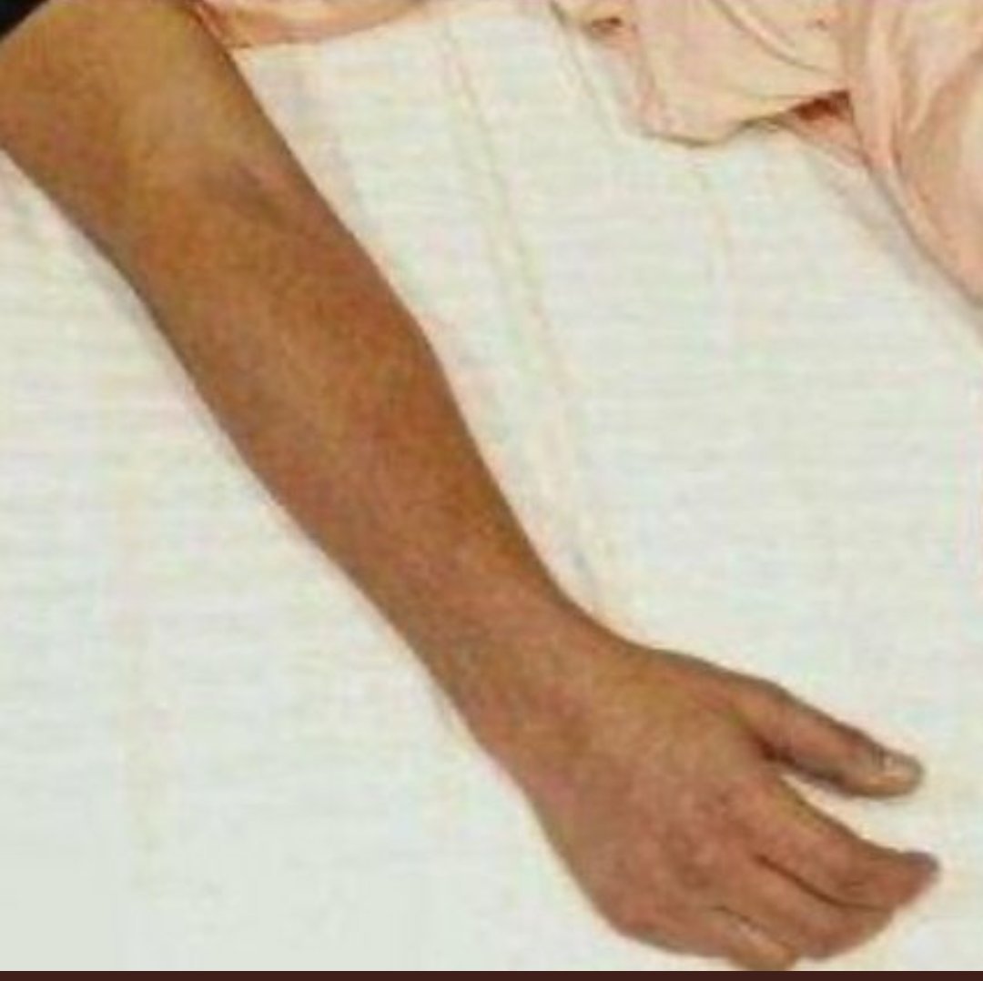 jackkate4ever's tweet photo. CBI we all know there was two bodies on 14th June taken in  Ambulance , the Question remains unanswered wht happened to tht another body of a minor girl ? &amp; Postmortem was done on which body.??
@PMOIndia @HMOIndia @MLJ_GoI

SSR News Published In Morning
#boycottbollywood https://t.co/WEPJp72VcQ