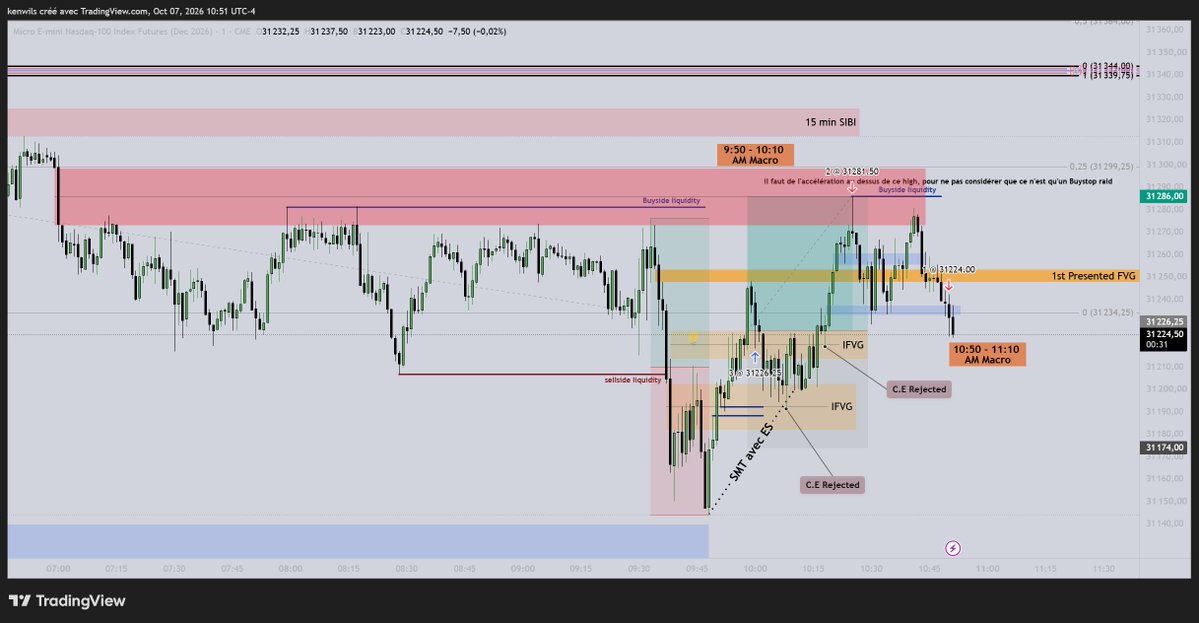 WilsonKenzo's tweet photo. PETIT TP, MAIS TP QUAND MÊME !!! (+0.7R) 💸

Réalisé en live sur Youtube !!! 🔴🎥

4ème journée consécutive en gain !!! 🟢

Si vous voulez voir les raisons qui m'ont poussé vers cette position ainsi que ma lecture du Price Action --> Voir la chaîne YouTube ! https://t.co/lPbTnl0Ln7