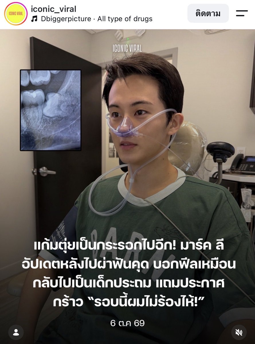 faiakacotton's tweet photo. แอคข่าวนี้เอาแชทมาร์คที่ส่งมาเล่าที่ไปถอนฟันคุดมาเขียนได้น่ารักมาก https://t.co/ExCXZ77Xns