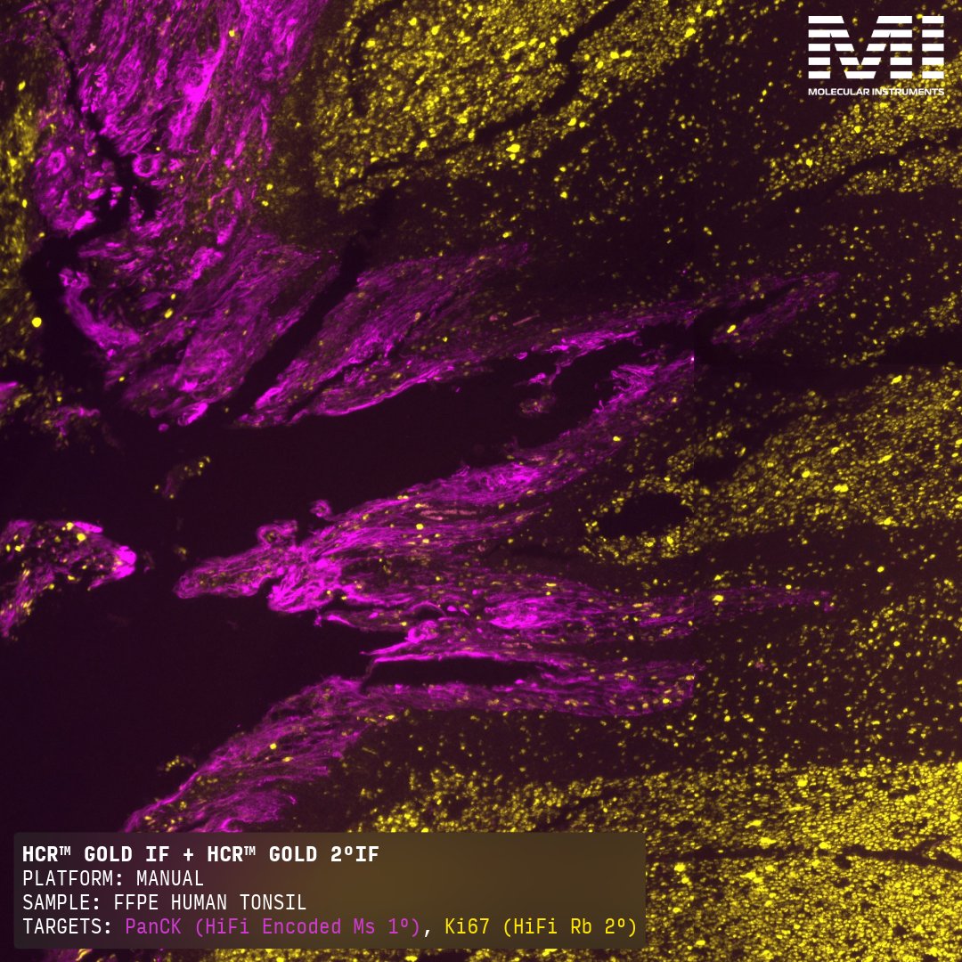 HCRimaging's tweet photo. Introducing HCR™ HiFi Secondaries!

We’re extending our proprietary HiFi background suppression technology to HCR™ HiFi Secondaries, giving researchers two powerful ways to multiplex protein labeling:

• HCR™ HiFi Encoders enable straightforward multiplexing with same-species primaries
• HCR™ HiFi Secondaries enable best-in-class amplification for the broadest range of primaries, including those raised in chicken, rat, goat, and other host species

Both can be combined in the same IF assay and are natively compatible with HCR™ Gold RNA-FISH for RNA + protein co-detection, allowing you to select the best approach for your research.

Shop HCR™ Gold 2°IF today: https://t.co/Pawxa64ju1