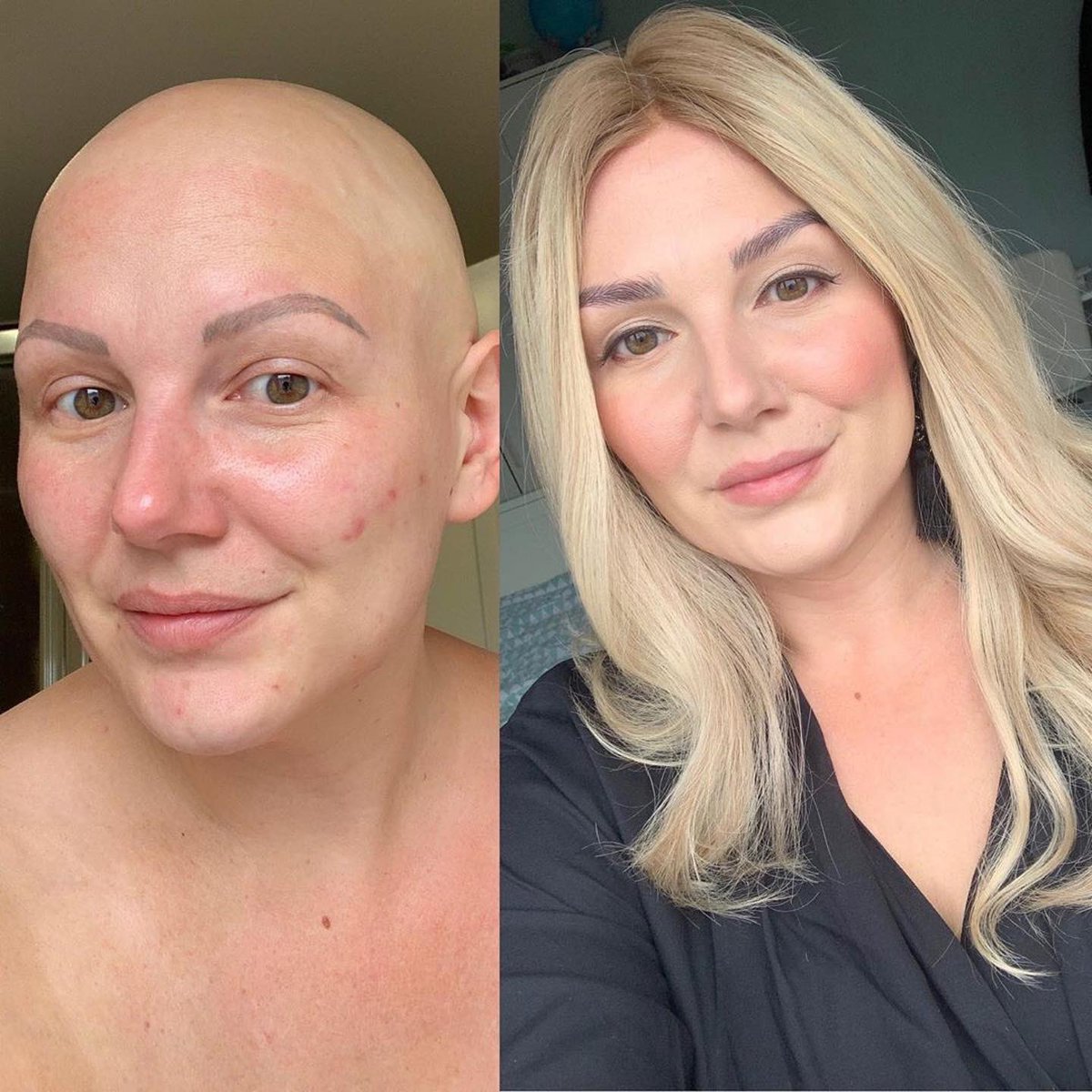 FolleaHair's tweet photo. ✨ Friendly reminder: You are beautiful, wig or no wig! 

We think @baldmothertucker looks stunning in both looks. Drop a ❤️ if you agree!

Featuring the FOLLEA Gripper Lite human hair wig in the gorgeous Vienna 11035. ✨

💕 #FolleaByDanielAlain

#Follea #wig #hairtransformation https://t.co/XY7cL6pGeH