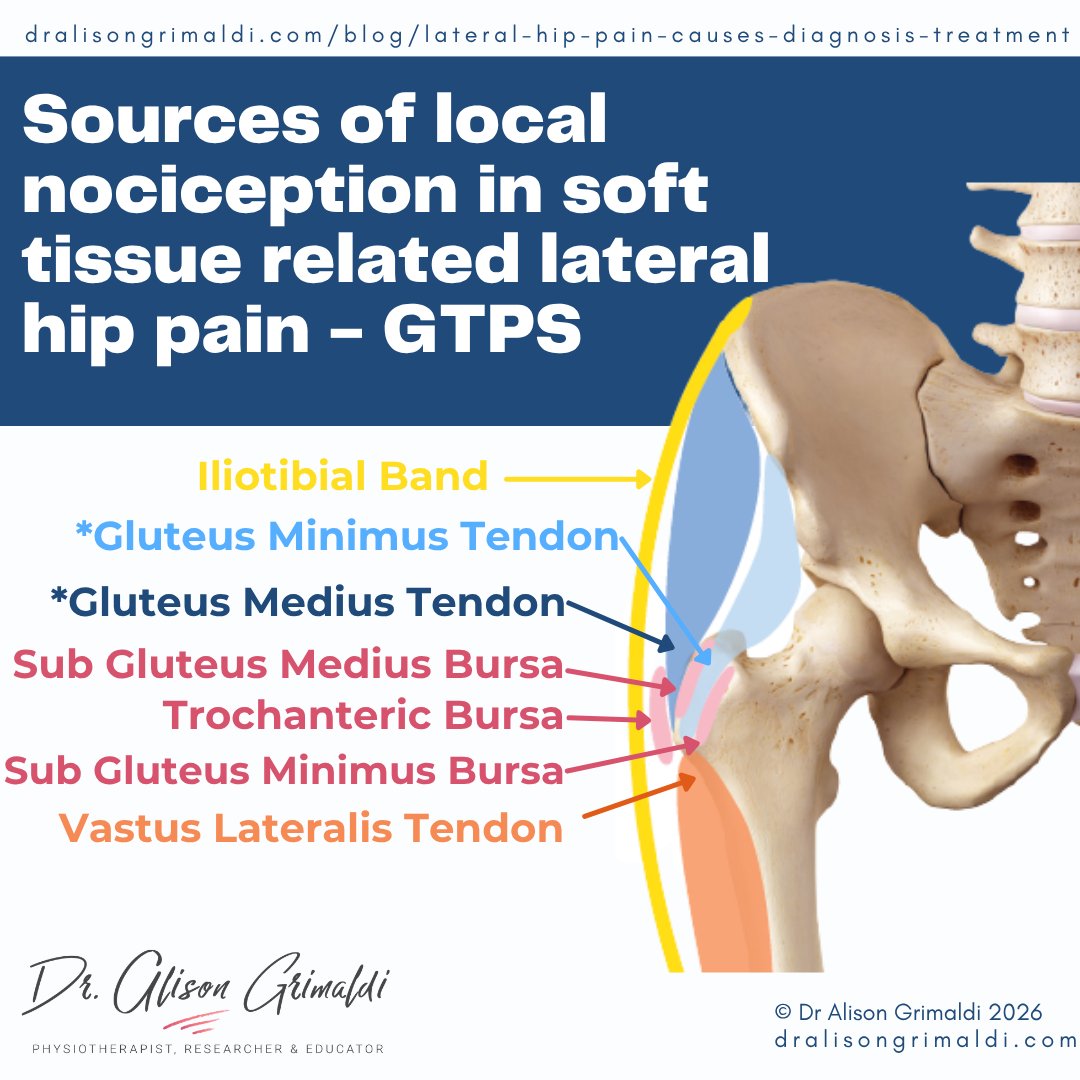 alisongrimaldi's tweet photo. 🧠 Lateral hip pain is often assumed to be trochanteric bursitis. But what does evidence say about the soft tissue pathologies most commonly associated with GTPS?
🔎 Explore potential sources of local nociception + what this means for clinical reasoning.
https://t.co/XKavrMtQo9 https://t.co/iaEAVb6qrH