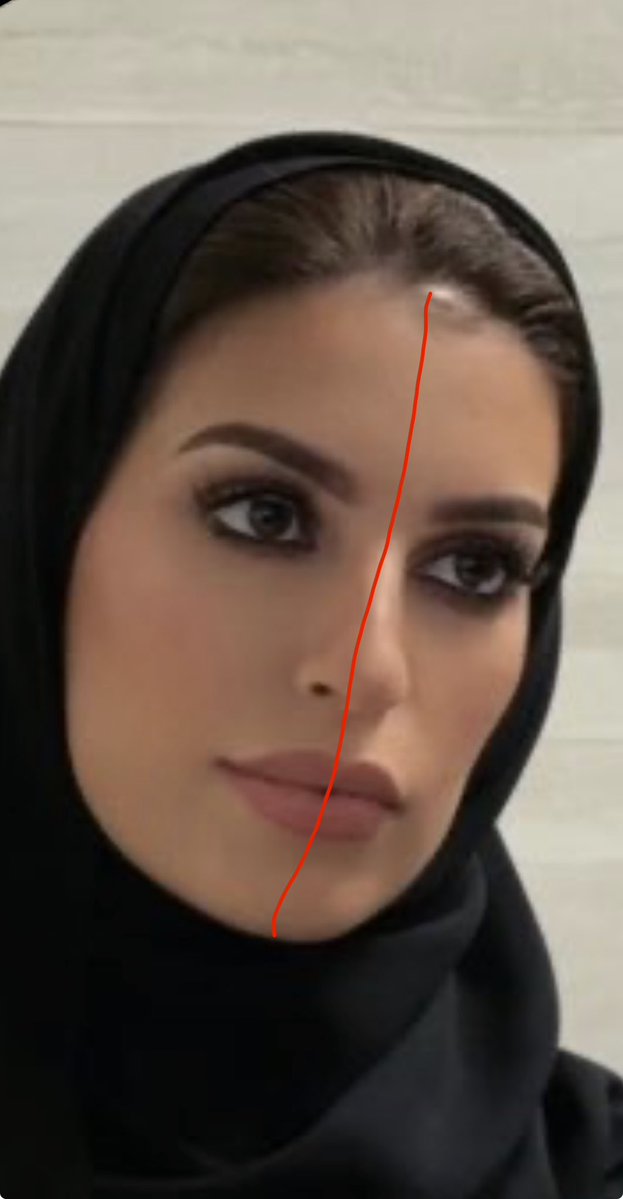 Pfbca's tweet photo. @mmajdda ماجدة حسب تخميني الشخصي وجهك طوله ٦٣ سانتي روحي أنتي وياه هو خليه يعالج لثغته المعاق وأنتي شوفي لك احد يرفع وجهك المترهل ضروري https://t.co/cChU8PgJKp