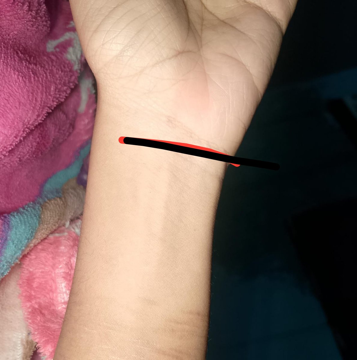 Kyaaaaya's tweet photo. Quisiera kortsre ahi, pero me da miedo Ed que se ve hasta el hueso ese, no tengo mucho grasa ahí https://t.co/8P9cm9EYLR