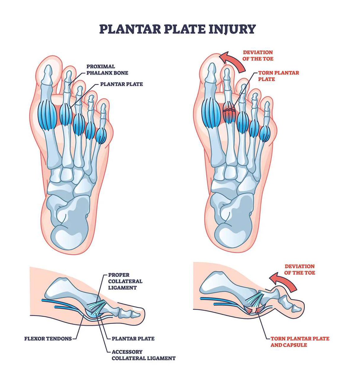 stat_dunk's tweet photo. 🚨 Nurkic set to miss 4+ weeks with a torn plantar plate tear
Look for Jaxson Hayes or Kyle Flipowski to start the season
#fantasynba #fantasybasketball #fantasybball #utahjazz https://t.co/wDENmxNtdI