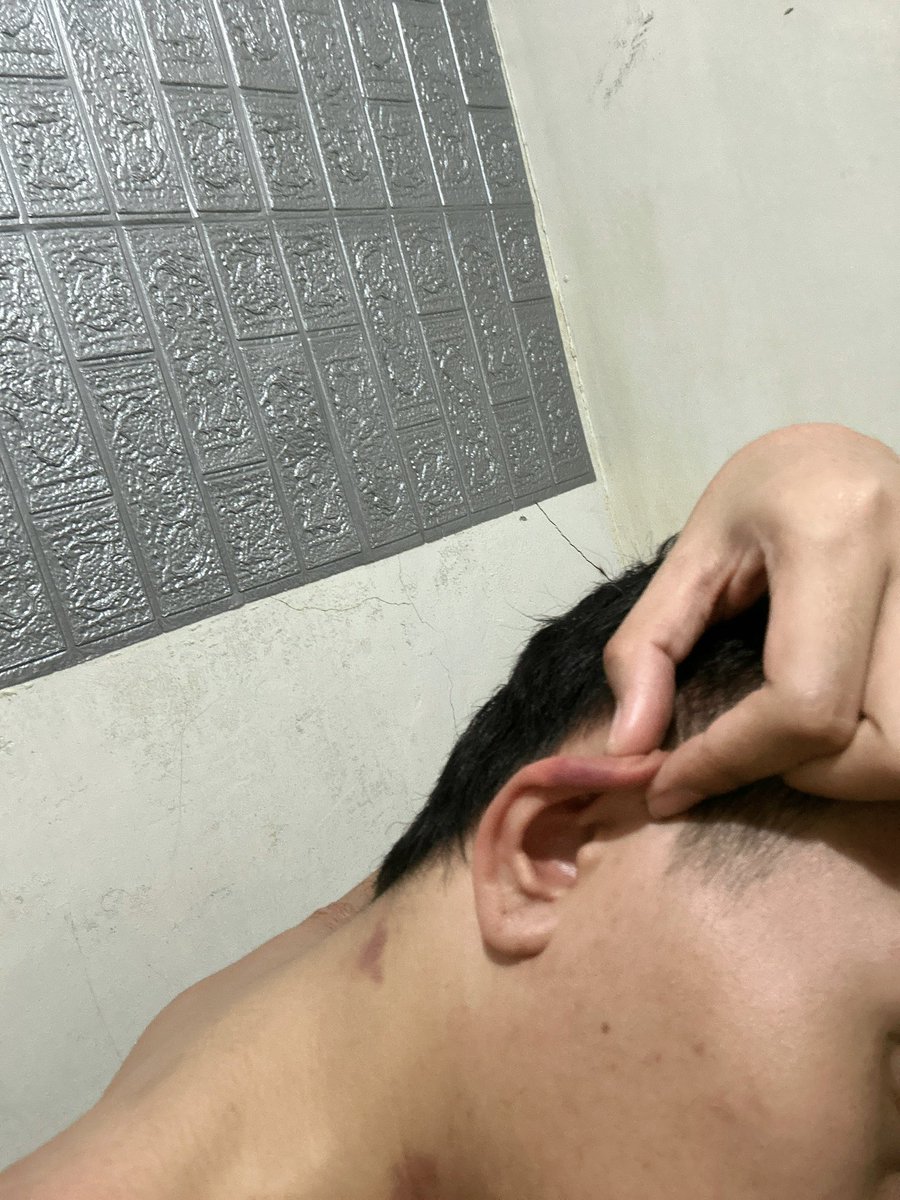 PwrBttmmm's tweet photo. Love marks 💋 sa sobrang libog pati tenga ko nilagyan HAHA!
#DavaoAlter #alterdavao #alterdvo #alterph #alterpinoy https://t.co/kPqVLiWJRB