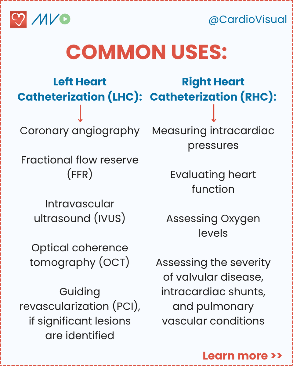 CardioVisualApp's tweet photo. 🫀 Left vs Right Heart Catheterization, what's the difference?

Save &amp; share with your clinician peers!

Follow us @CardioVisual for expert-led visual cardiology!

#Cardiology #CathLab #Catheterization #Hemodynamics #MedEd #MedStudent #CardioFellow #InterventionalCardiology https://t.co/9iB6Ro3Ce7