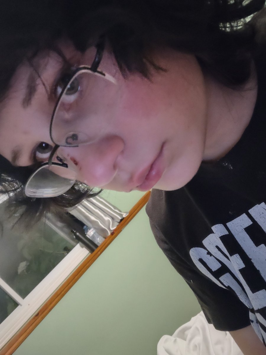 swaglikeits2016's tweet photo. I look ugly when I cry https://t.co/mynBilmFaG