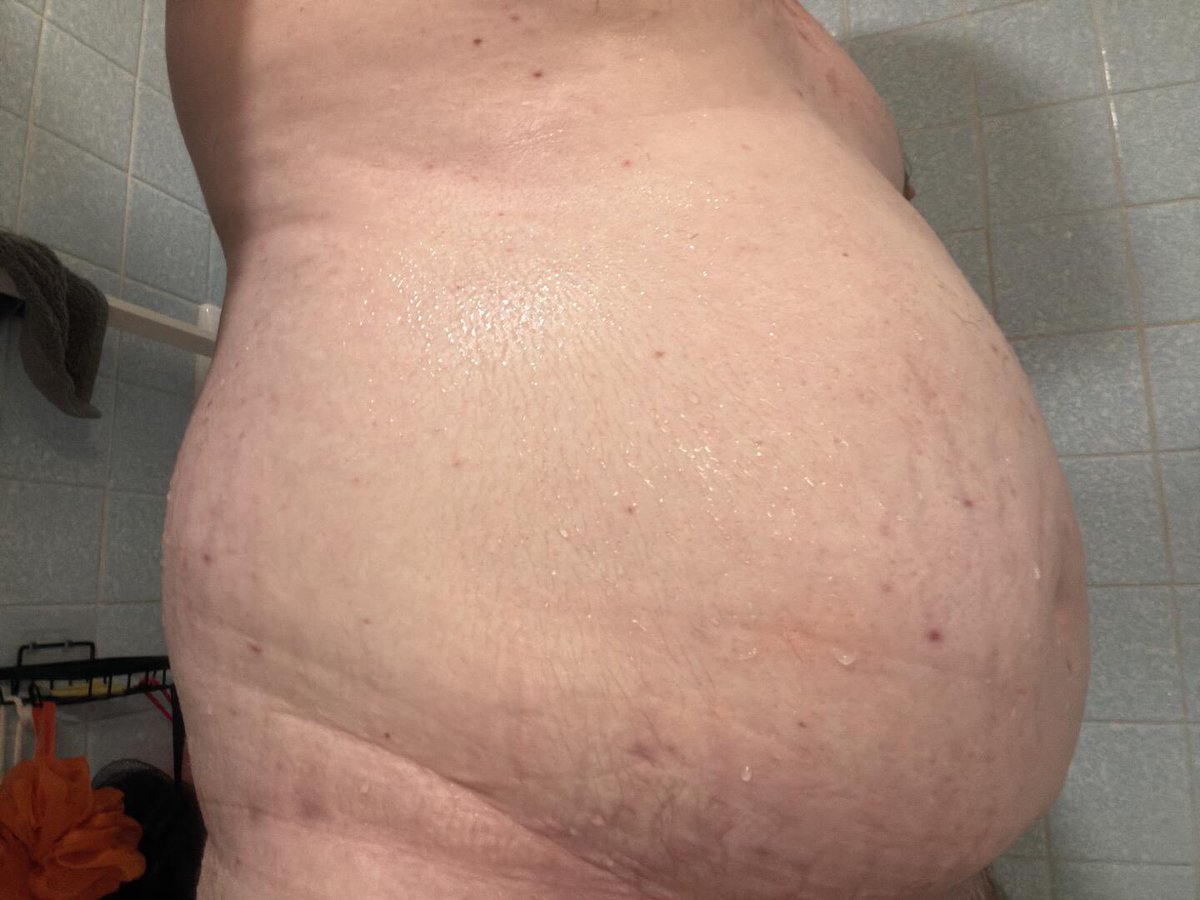 BlobbyDan's tweet photo. Freshly shaved belly
#feedee #feedeebelly #malefatty https://t.co/cs0dsOshF4