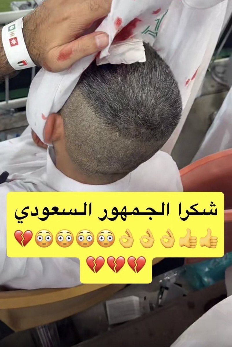 givv_8's tweet photo. @SirM70 انا خلاص وصلت لقناعة انتم علاجكم الحجامه كل موسم تعالو نحجمكم وترجعون بلدكم والله بتتعافون https://t.co/zGZRr9dgnt