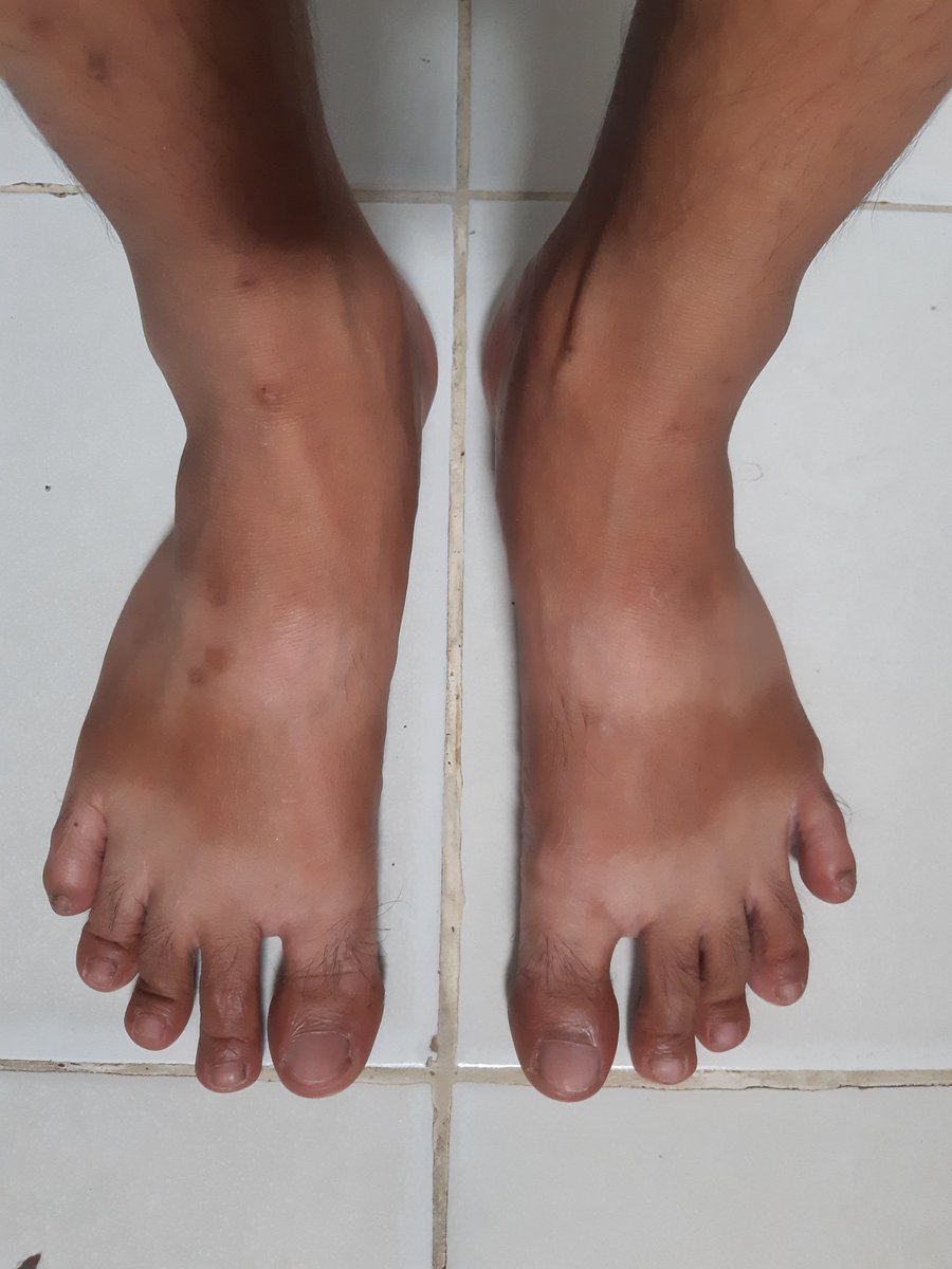 handsomalefeet's tweet photo. https://t.co/yPKrps0HQn
