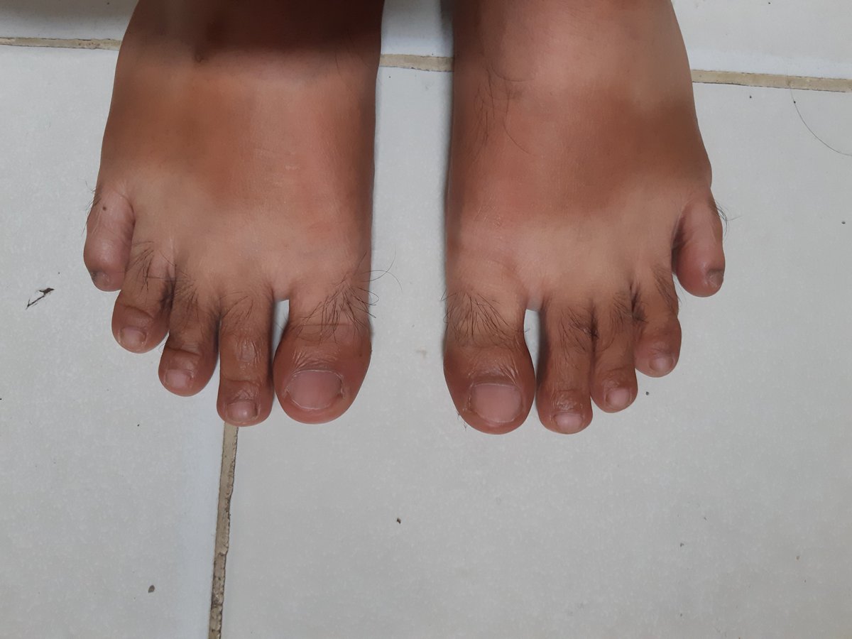 handsomalefeet's tweet photo. https://t.co/yPKrps0HQn