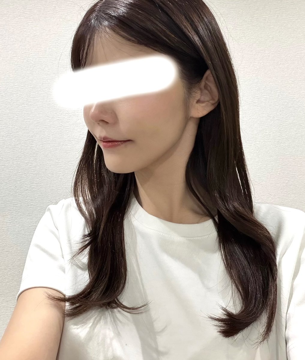 hana___24_'s tweet photo. 【糸リフトDT7日目】
頬下がまだ一部黄色いけど、それよりか日々若返りを感じて本当に感動、、、！！！
リフトアップはもちろんだけど肌質がめちゃよくなって化粧のり最高すぎる！！
昨日までは時折り頬の痛みがあったけど、丁度施術から1週間で痛みも顔の違和感も気にならなくなった！ https://t.co/nQ2STt3ZjD