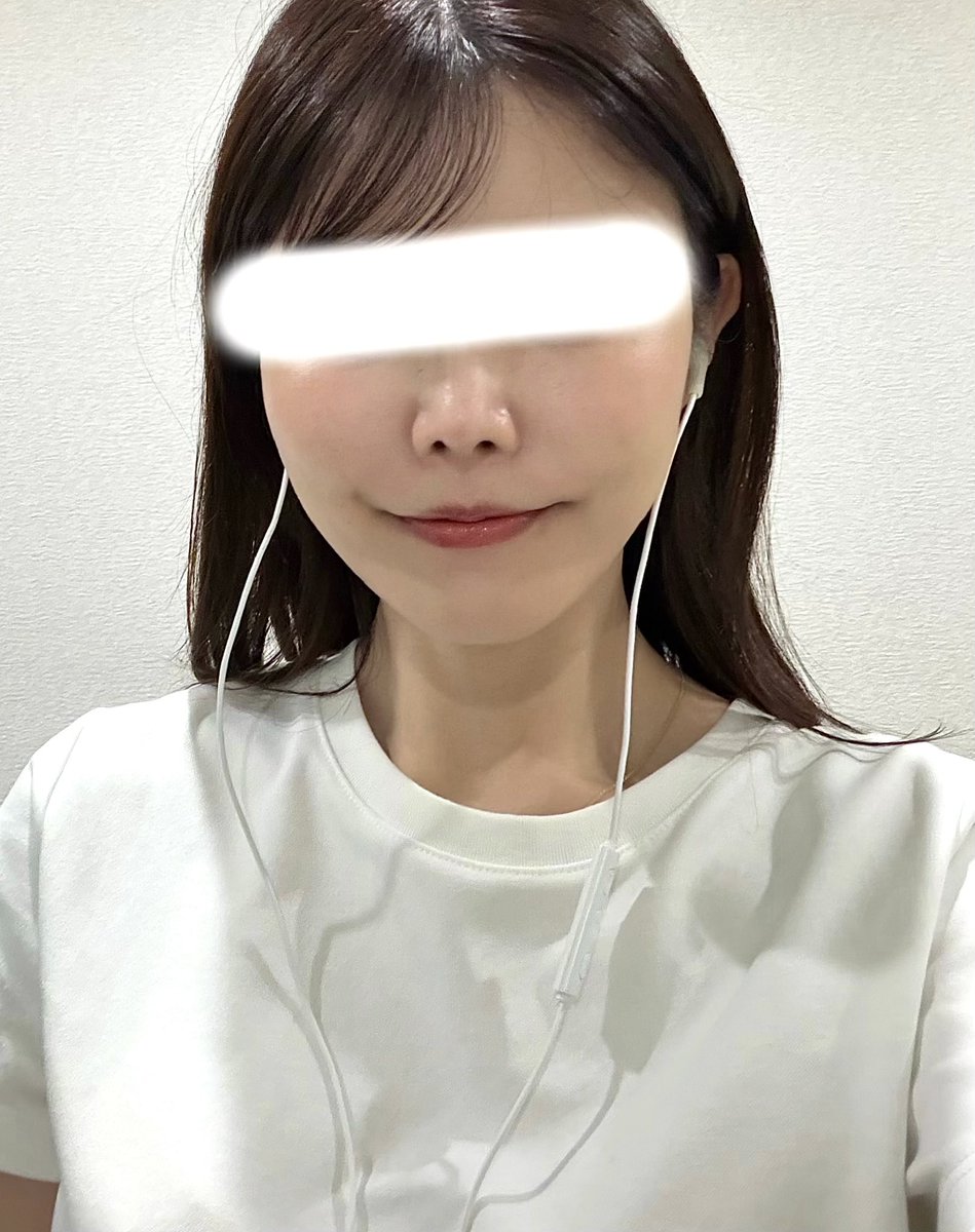 hana___24_'s tweet photo. 【糸リフトDT7日目】
頬下がまだ一部黄色いけど、それよりか日々若返りを感じて本当に感動、、、！！！
リフトアップはもちろんだけど肌質がめちゃよくなって化粧のり最高すぎる！！
昨日までは時折り頬の痛みがあったけど、丁度施術から1週間で痛みも顔の違和感も気にならなくなった！ https://t.co/nQ2STt3ZjD