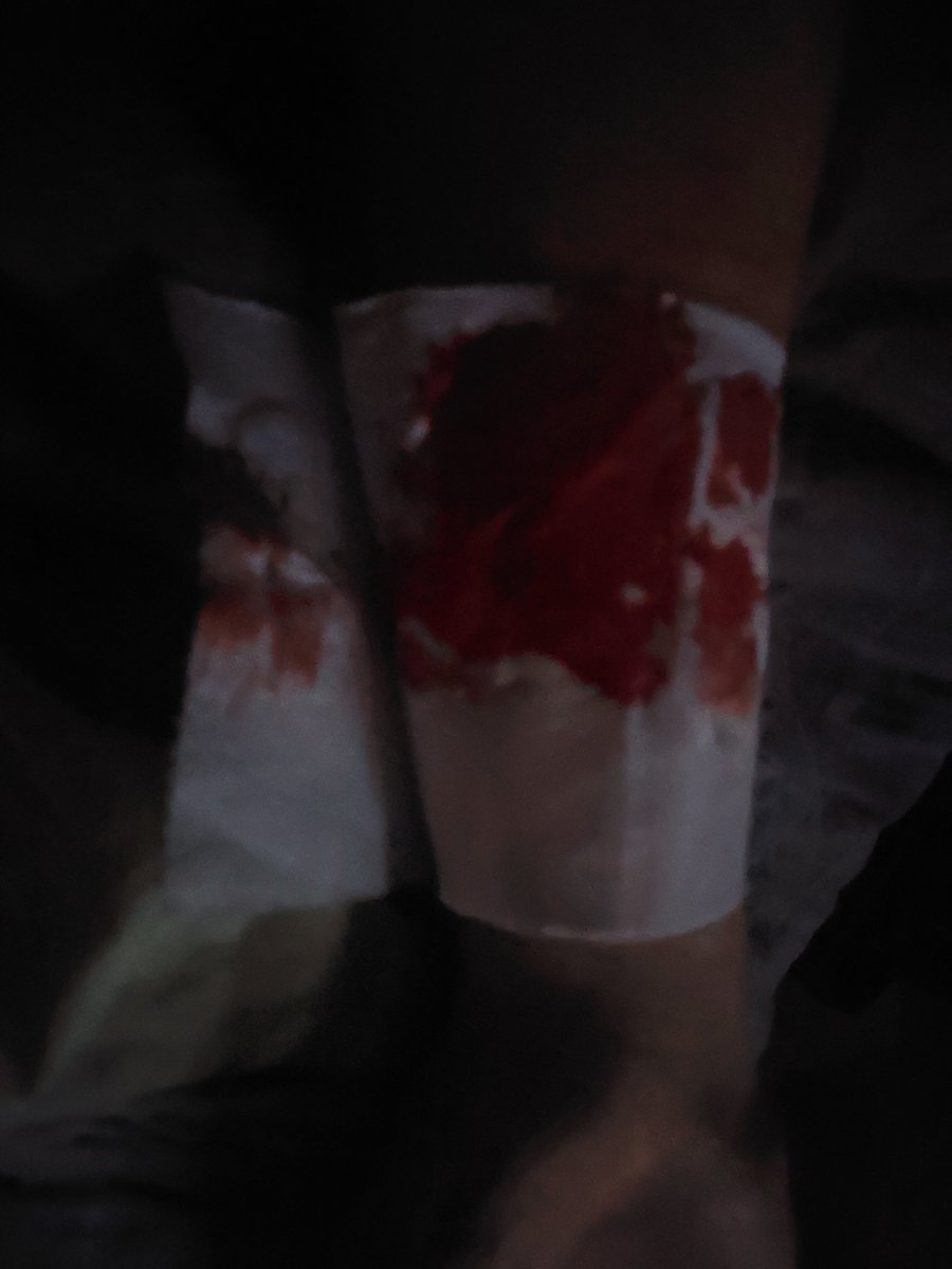 Timofeyshusband's tweet photo. Oh no, I spilled ink on myself.

#Shrtwt #shedrtwt #redinktwt https://t.co/M0LDfXgkbl