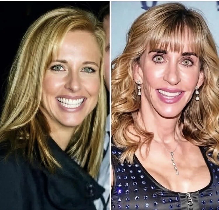 Suzierizzo1's tweet photo. This is before and after Maralago  photos of Susan Dell . https://t.co/wpv6sFmKE0