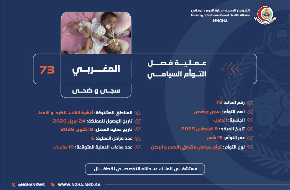 NGHAnews's tweet photo. إنفاذًا لتوجيهات خادم الحرمين الشريفين الملك سلمان بن عبدالعزيز وسمو ولي عهده الأمين -حفظهما الله-، تُجرى حاليًا عملية فصل #التوأم_السيامي_المغربي سجى وضحى، في مستشفى الملك عبدالله التخصصي للأطفال بمدينة الملك عبدالعزيز الطبية بالرياض، التابعة للشؤون الصحية بوزارة الحرس الوطني.

وتُجرى العملية على ٦ مراحل، ويُتوقع أن تستغرق ١٠ ساعات، بإذن الله.

#MNGHA