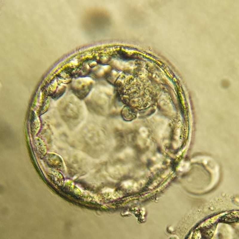 NatuVitro's tweet photo. In IVF, a fertilized egg develops through several cell divisions before reaching the blastocyst stage, usually on day 5 or 6. Embryo transfer places it in the uterus, where implantation may occur. Our team can support you.
https://t.co/7InedLsHcT https://t.co/DbFsoQaMDQ
