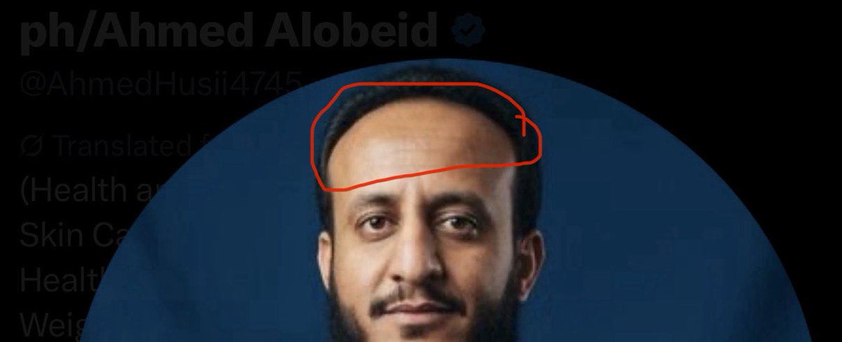 padihuma22's tweet photo. @AhmedHusii4745 But the front of your hair looks kinda bald https://t.co/vy3eyLusEo