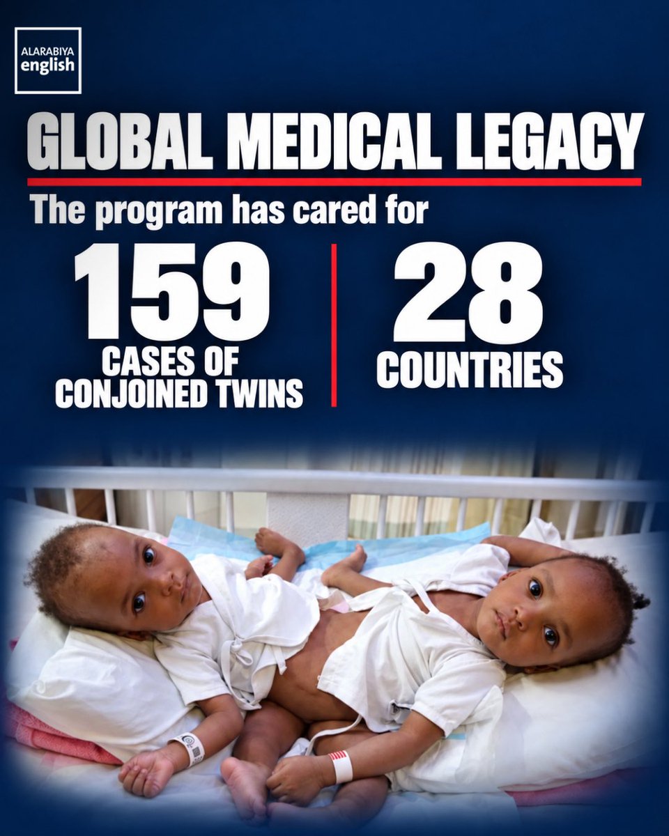 KhalidHabash's tweet photo. It’s another day to wake up and feel proud to be a Saudi Arabian 🤍🇸🇦
Today, Saudi Arabia completed its 73rd conjoined twin separation surgery in Riyadh, separating Saja and Doha, 13-month-old Moroccan twins joined at the chest and abdomen.
Led by Dr. Abdullah Al-Rabeeah, 23 specialists worked six stages over ten hours. The twins shared heart membranes, liver, and intestines.
While other countries demanded a $1 million upfront, Saudi covered everything: travel, accommodation, surgery, medications, the medical team, and lifelong care, for this family and for many others.
Since 1990, the Saudi Conjoined Twins Programme has cared for 159 sets of twins from 28 countries across five continents. Thirty-five years of non-stop Saudi goodness to the world, and no one comes close.
Saudi Arabia is a force of good in this world. That’s what makes me proud. 🇸🇦