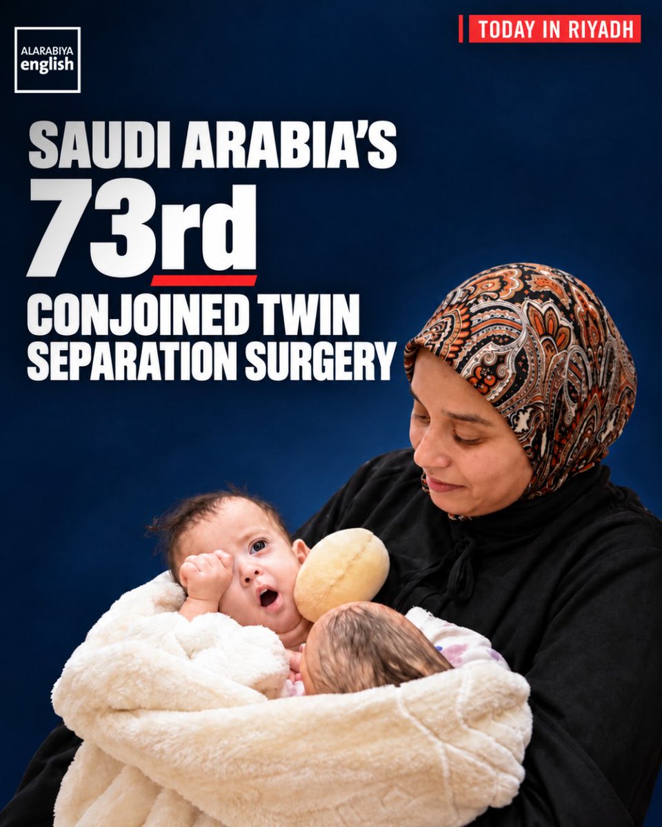 KhalidHabash's tweet photo. It’s another day to wake up and feel proud to be a Saudi Arabian 🤍🇸🇦
Today, Saudi Arabia completed its 73rd conjoined twin separation surgery in Riyadh, separating Saja and Doha, 13-month-old Moroccan twins joined at the chest and abdomen.
Led by Dr. Abdullah Al-Rabeeah, 23 specialists worked six stages over ten hours. The twins shared heart membranes, liver, and intestines.
While other countries demanded a $1 million upfront, Saudi covered everything: travel, accommodation, surgery, medications, the medical team, and lifelong care, for this family and for many others.
Since 1990, the Saudi Conjoined Twins Programme has cared for 159 sets of twins from 28 countries across five continents. Thirty-five years of non-stop Saudi goodness to the world, and no one comes close.
Saudi Arabia is a force of good in this world. That’s what makes me proud. 🇸🇦