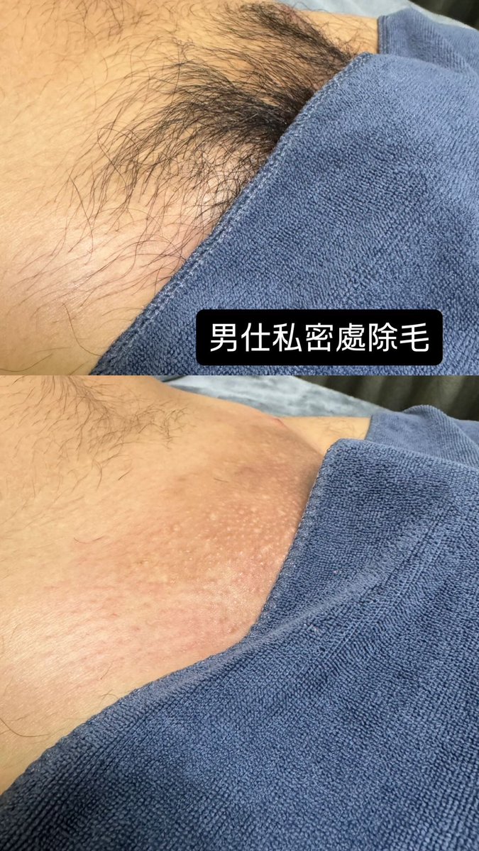 Zhen1103_'s tweet photo. 找我除毛好嗎 https://t.co/DrLwggKqwY