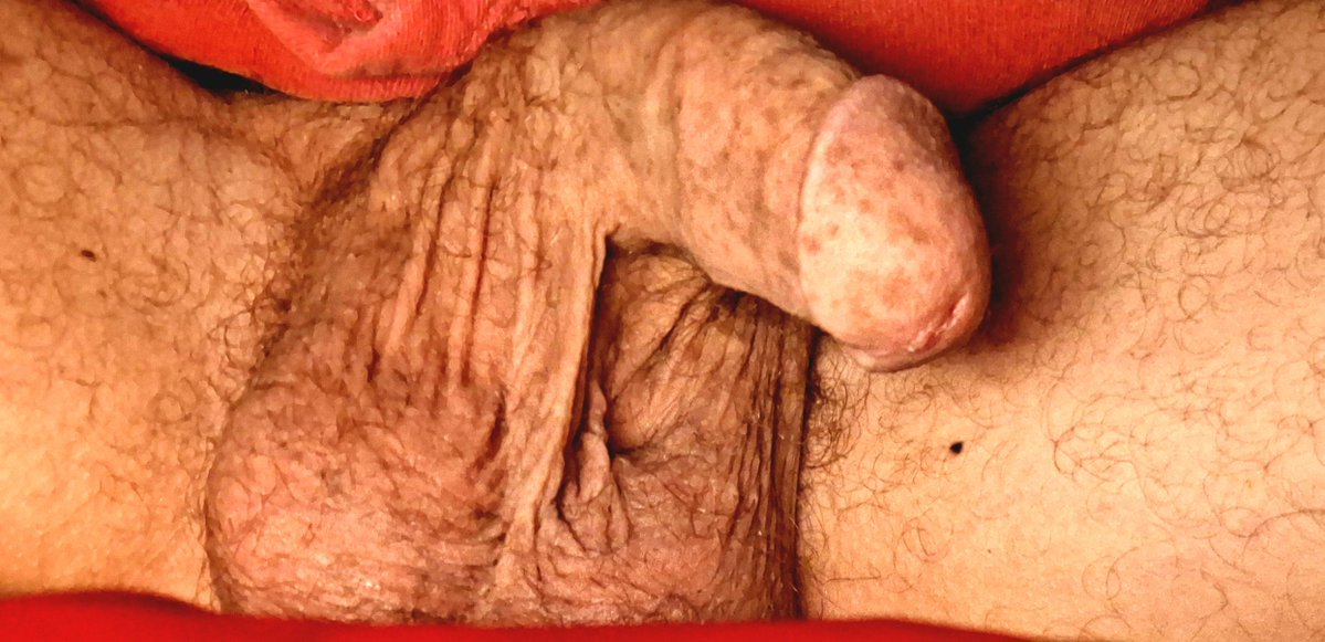 hornykinkyfun's tweet photo. A sexy, warm and euphoric penis photo shoot🤭😋☺️🤪🥳 #penis #fun #balls #cock #nonerect #hangingout #scrotum #warm #jugglemytesticles #pussy #pleaseme #GILF #MILF #Fit #pubes #wet https://t.co/DvYwLdqmSj