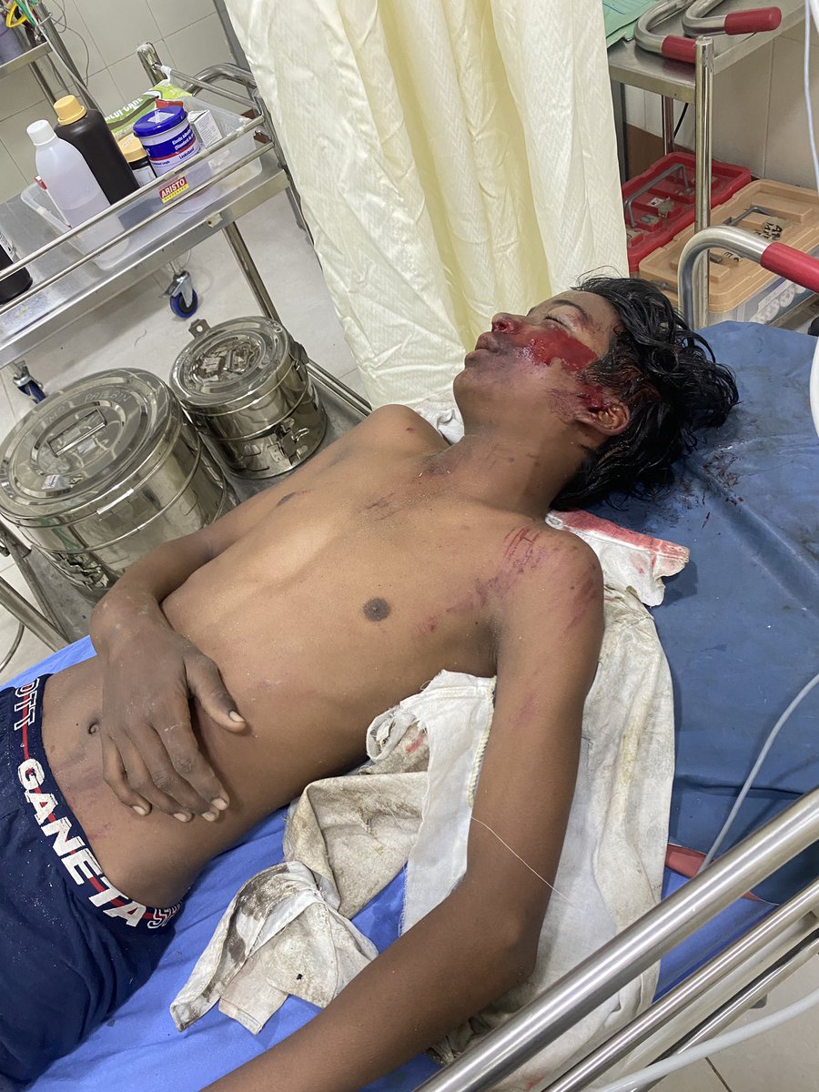 Rocky_762585's tweet photo. Rey TFI Fans 🙏
show ur concern to Karnataka TFI banisa ….
Young kid met with an accident by unknown drunken fellows  and severely injured .
Everyone help as much u can  
Mainly AArmy ,u should help he is a diehard Allu Arjun fan
Make some efforts raa 🙏🙏 https://t.co/DE0doqSEfk