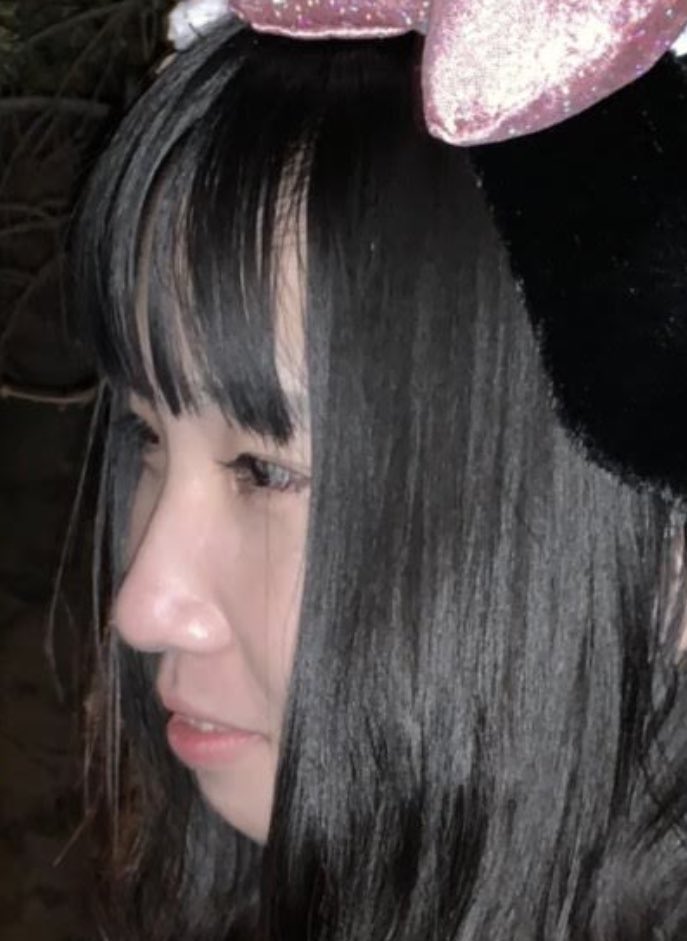 横顔はこんな感じだよ！
鼻翼基部から持ち上がったことで陥没感や法令線消えて一気に美に近づけたよ〜

あとは、抜歯は要るけど歯列矯正、Cカール形成、額脂肪移植とかでこの横顔は作られたよ https://t.co/9ooLNfVQrE