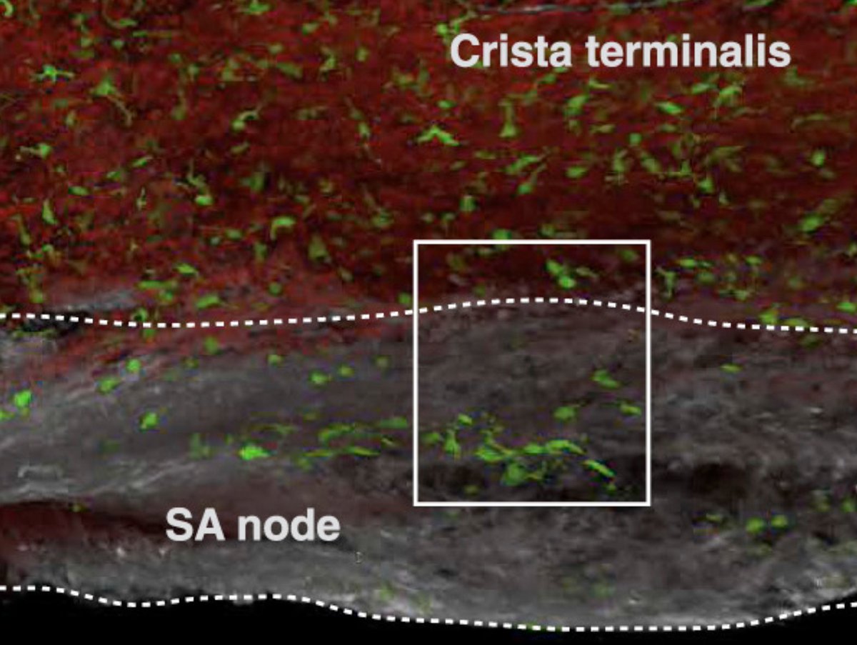 MatthiasNahrend's tweet photo. In @Nature: @teichlab confirms increased tissue resident macrophage density in the ♥️ conduction system, with focus on developing sinus node: https://t.co/8VJ1F4hkM8

Please see screen shots from @MaartenHulsmans  paper: https://t.co/VJZBGOtjWA

But what are these macs doing 🤔 https://t.co/L6iDkejdKH
