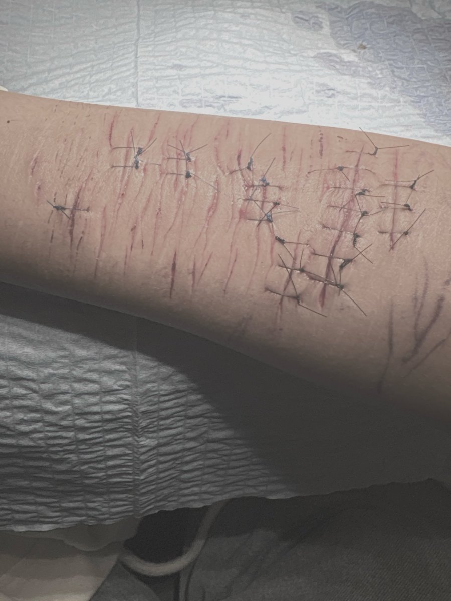 mezzinqz's tweet photo. fake halloween makeup #sfx https://t.co/YRlJ4TRdHi