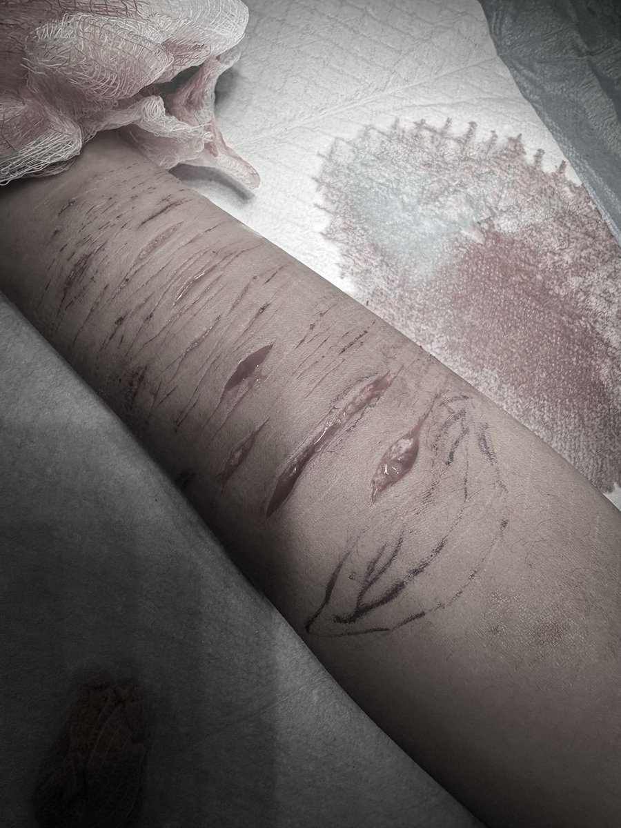 mezzinqz's tweet photo. fake halloween makeup #sfx https://t.co/YRlJ4TRdHi