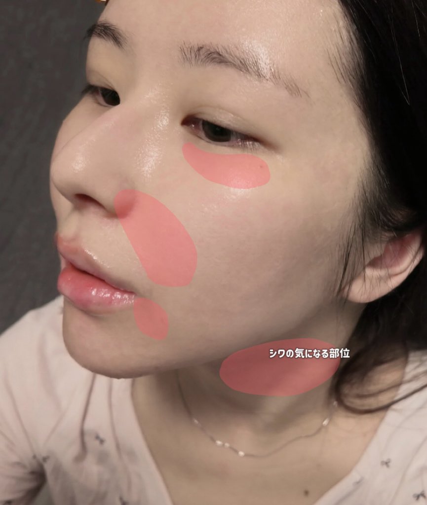 目元とか口元がしんなりしてきた気がする24歳、もう昔みたいに常にハリがあるわけではないんだな〜と気を引き締め、プラセンタとボルフィリンぬりぬりする日々。アイクリーム代わりにもなるからズボラにもありがたい。頼むからハリ復活してくれ〜〜〜【PR】medicube https://t.co/TBmNVeIcpQ