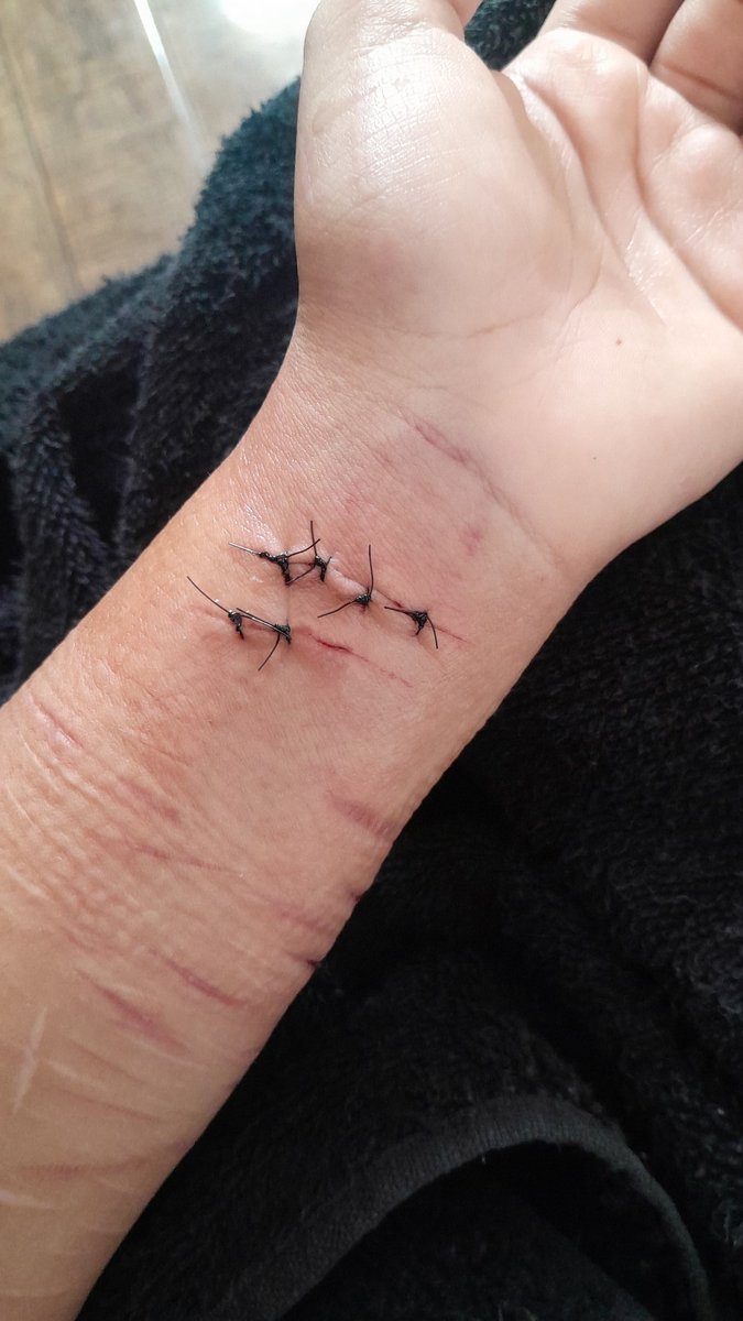 Theflayerman's tweet photo. @Kyaaaaya hi don't do this i litterally cut my radial artery https://t.co/fgwgj0R8yL