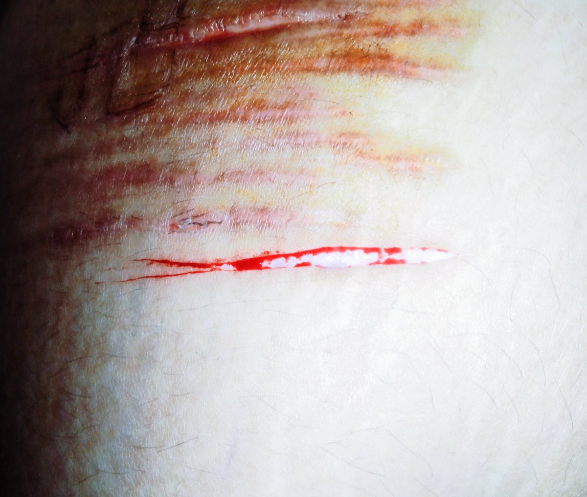NeilTamboerijn's tweet photo. ( fake , sfx makeup , for educational purposes , do not take down ! )

this one was smoother but im not planing to do much https://t.co/XLJmkKoeCZ