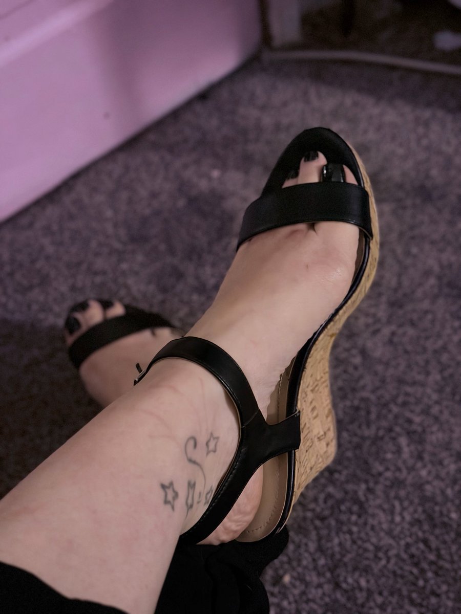AnnaSilkMarie's tweet photo. @AdamRodrigoso I wonder if you’re okay with the scars🥺 https://t.co/yc6Kb5IiQC