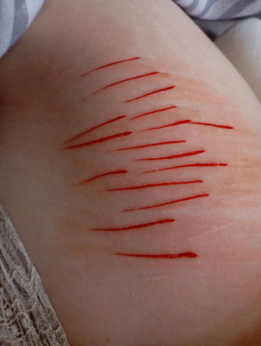 ghpsxxff's tweet photo. Why do the shallow ones always sting so bad omfg 
It's better than the like dull ache of deeper ones but shit https://t.co/gEtWRiq3D8