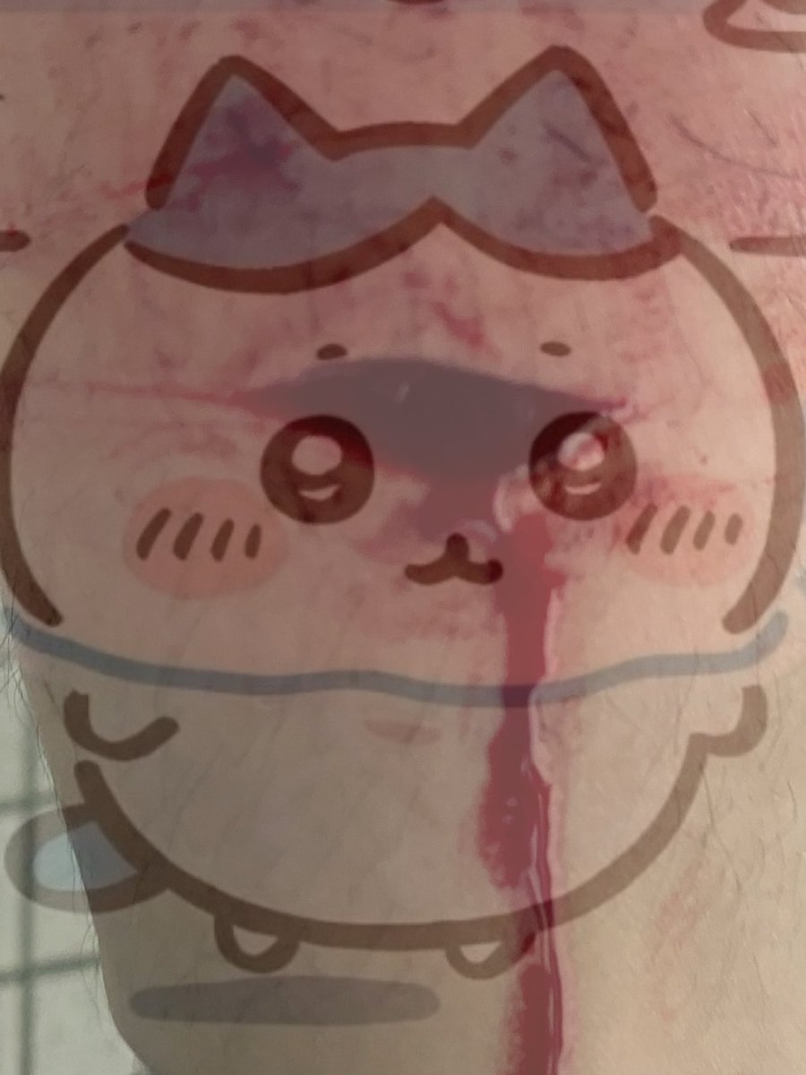 Calicornyvnb's tweet photo. Beans in the school bathroom 😟😟
Fake sfx makeup art professionally done by me 
Fake body 
#shed #shedtwt #sh #sharmtwt #sharm #shtwt https://t.co/U5UwDrvVd5