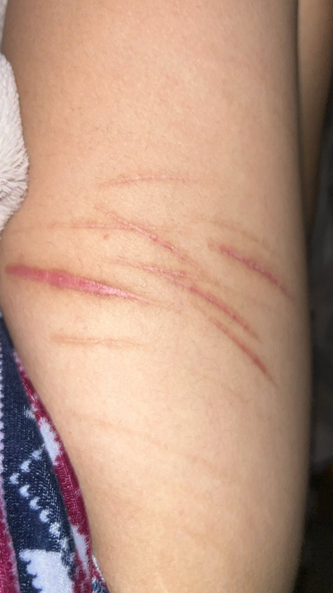 ugliestform's tweet photo. ive been put into forced recov and its like having my fat cock put in a chasity cage #shedrtwt https://t.co/gFurplSxqu