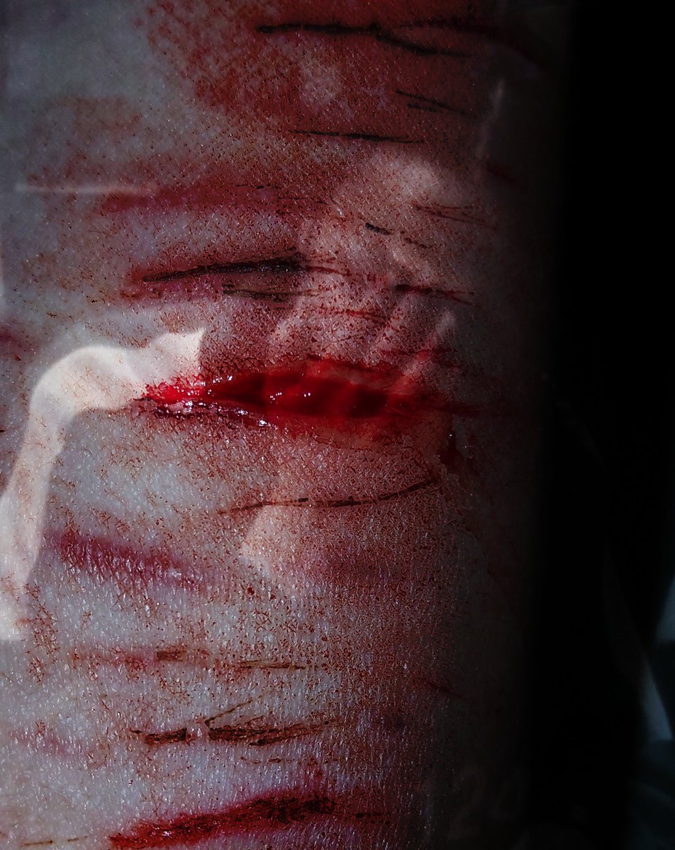gurogyu_'s tweet photo. day 0 vs day 7

practicing sfx for halloween
#shrtwt #sfxtwt #fake #sfx #slittwt #988twt https://t.co/LJHFZp1Xia